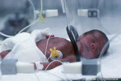 新生儿呼吸窘迫综合征 早产儿发育迟缓的表现症状